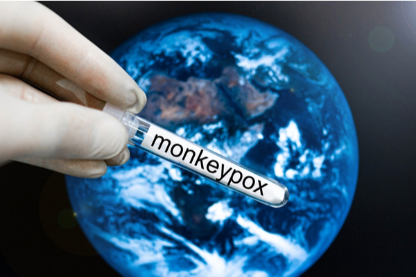 Lire la suite à propos de l’article Variole du singe (monkeypox) : mobilisation de la réserve sanitaire !